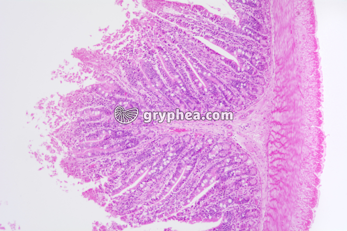 Valvule connivente x25 - gryphea.org